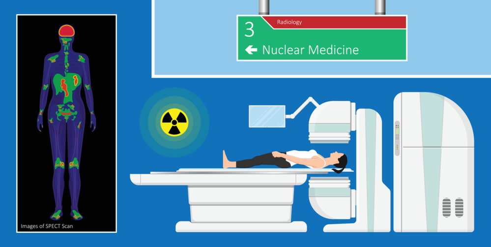Nuclear Imaging Illustration of Nuclear Imaging machine and SPECT Scan